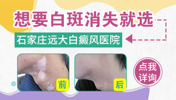 孩子洗澡的时候发现一个白点是什么