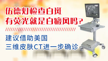 嘴角两片白斑在伍德灯下是淡白色是白癜风吗