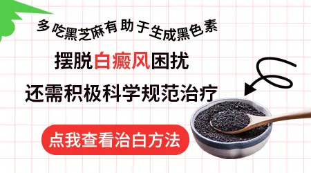 脸上长白癜风怎么治能治好