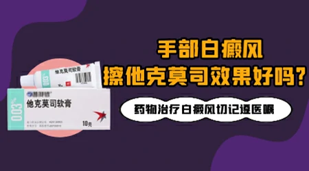 手背上的白癜风擦他克莫司效果好吗