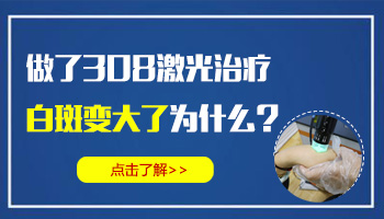 白癜风为什么照308激光面积越大