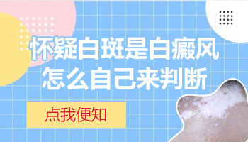 白斑一搓发红是不是白癜风