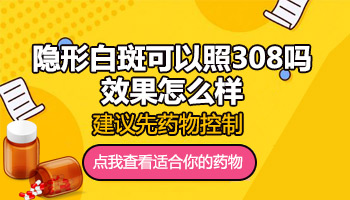 隐形白斑能照光吗