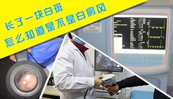 如何确定白斑是什么病 有白斑怎么治