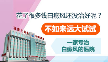 治白癜风可以报销吗 哪些药物在报销范围内