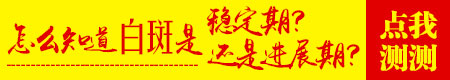 白癜风一年多了一直不变大也不变小
