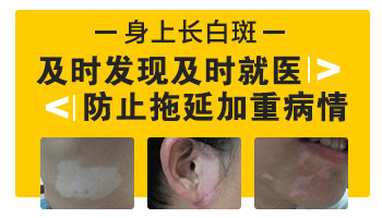 为什么腿上会有一块白的皮肤