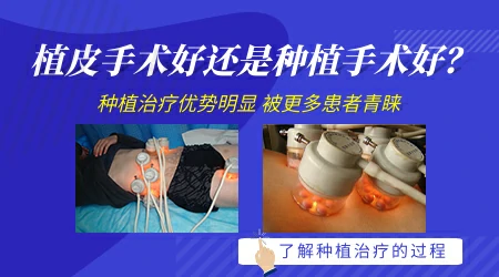 白癜风手术治疗有几种方法