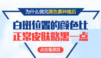 面部白斑植皮容易产生色素沉淀吗