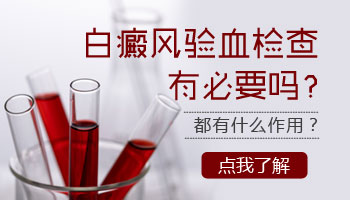 验血正常还会得白癜风吗 白癜风早期症状