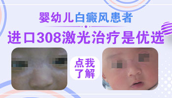 四个月宝宝白斑图片 早期白癜风症状图