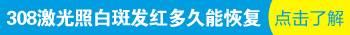 白癜风发展期能照光吗