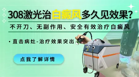 白癜风308激光每周照2次多久能看到效果