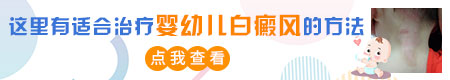 婴幼儿白癜风照几次308激光能见到效果