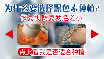 黑色素移植白癜风复发率高吗