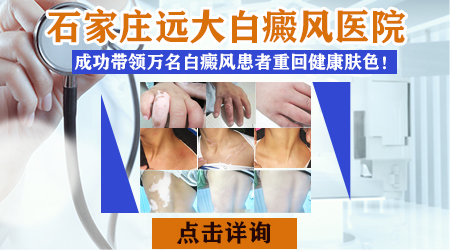 保定白癜风医院怎样 保定治疗白癜风费用贵吗