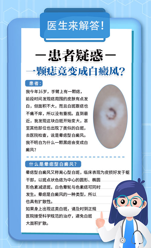 痦子周围的皮肤比别的地方白一点