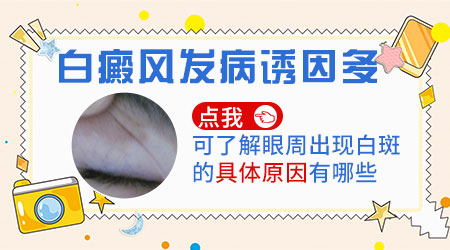 腿上有小白块是怎么回事 为什么皮肤会发白