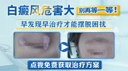 脸上晒后发红然后出现白块怎么回事