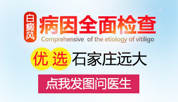 伍德灯和三维皮肤CT哪个检测白斑结果准