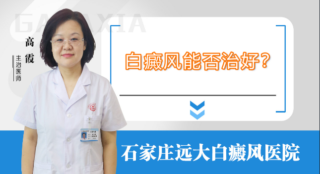 白癜风能不能治好?