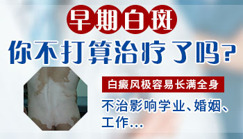 白斑不是很大还需要治疗吗