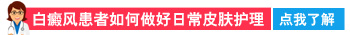 白癜风治疗多久可以控制住不在扩散