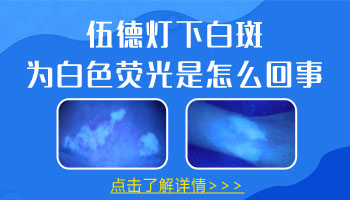 伍德灯下皮肤发白一定是白癜风吗