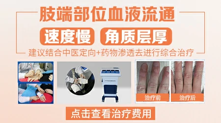 手指末端的白癜风光疗还有治愈希望吗