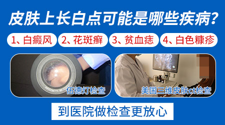 宝宝长汗斑的图片大全 汗斑和白癜风的区别