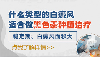 白癜风黑色素皮肤移植适合哪些人群