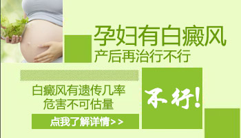 怀孕可以去做白癜风检查吗