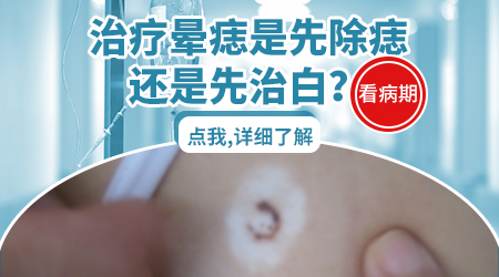 晕痣和白癜风一起发生先治哪个