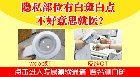 包皮白癜风照片