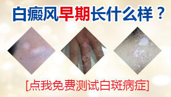 嘴唇白斑病早期症状图片什么样