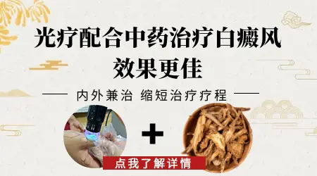 白癜风有没有用中药调理治好的