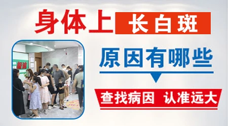 得白癜风的原因都有哪些 做什么检查能确诊病因