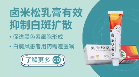 小孩白癜风能不能用卤米松乳膏