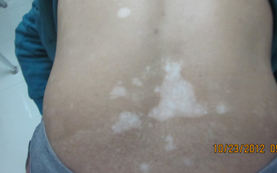 肚子上有小白点的图片