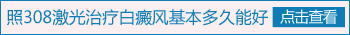 308准分子激光照一次几分钟