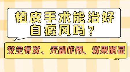 白癜风植皮视频 手术能治好白癜风吗
