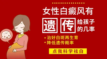 孕期长白癜风怎么能阻止遗传给宝宝