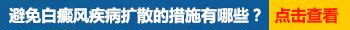 吃什么药能控制白癜风不扩散