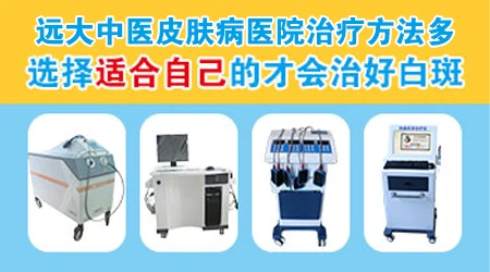 治疗白癜风用什么方法好