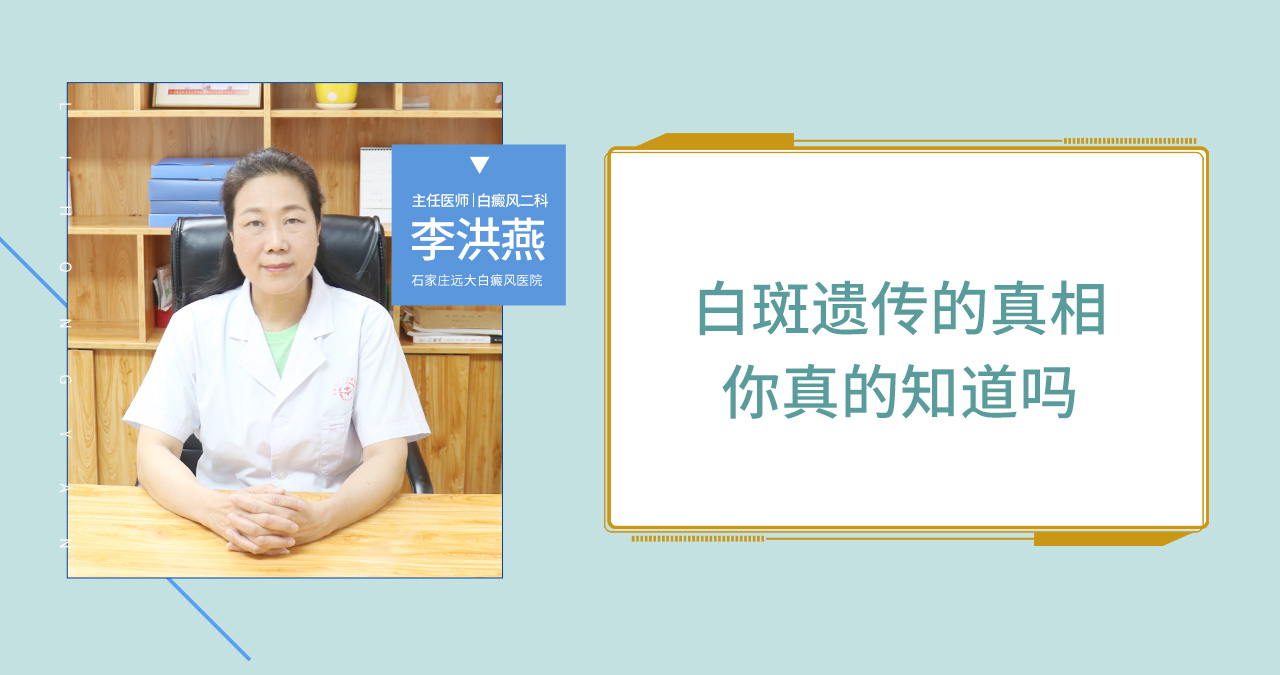 白斑遗传的真相你真的知道吗