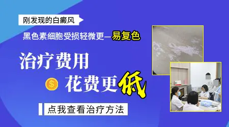早期白癜风治疗大概要花多少钱
