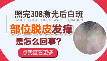 白癜风照308脱皮怎么回事