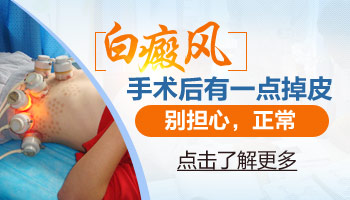 黑色素培植后拆完敷料后一周起皮