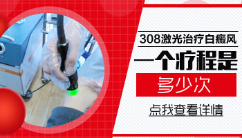 308光疗白癜风一个疗程需要做几次