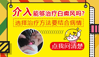 小腿发展期白癜风可以进行无痛介入吗